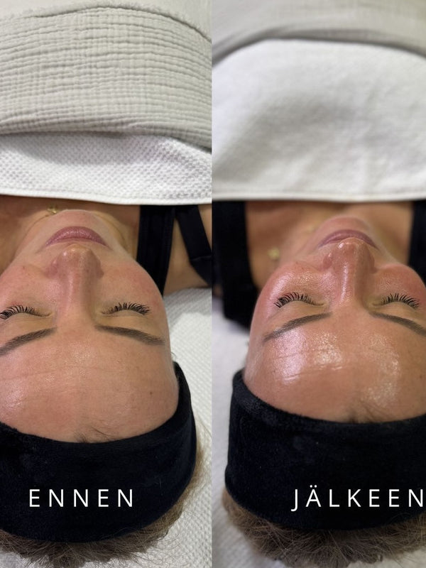 CELESTETIC Detox & Glow with Aquapeel